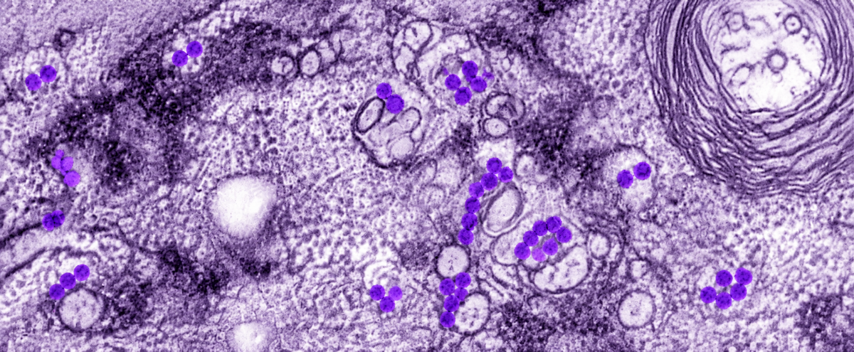 La-14 pH Regulator strain image