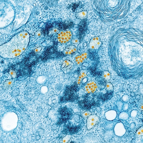 La-14 pH Regulator strain image